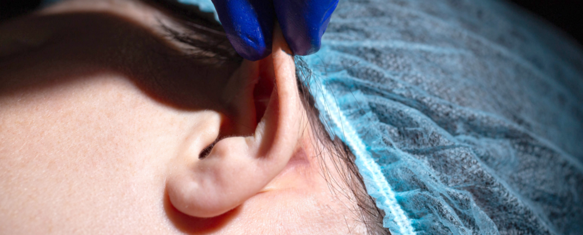Otoplastica a Torino